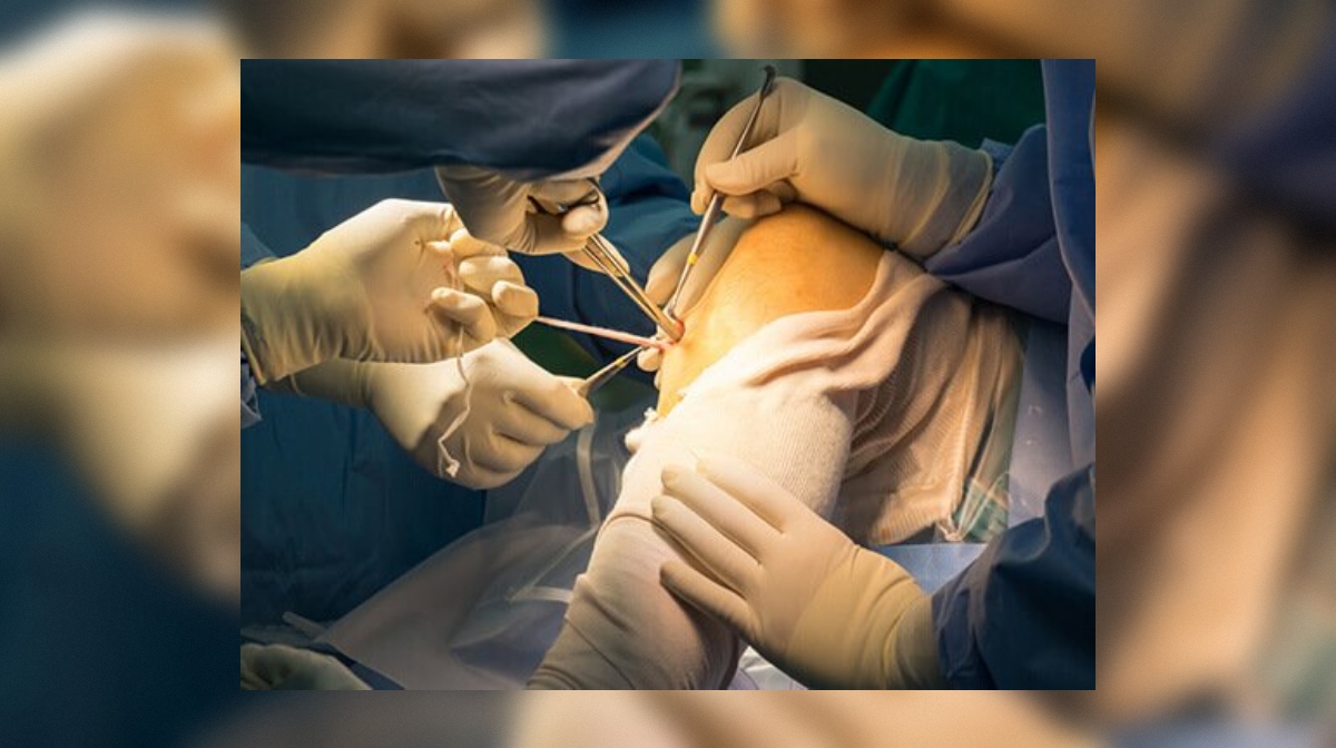 Opération Bloc — CCL (angle 2)